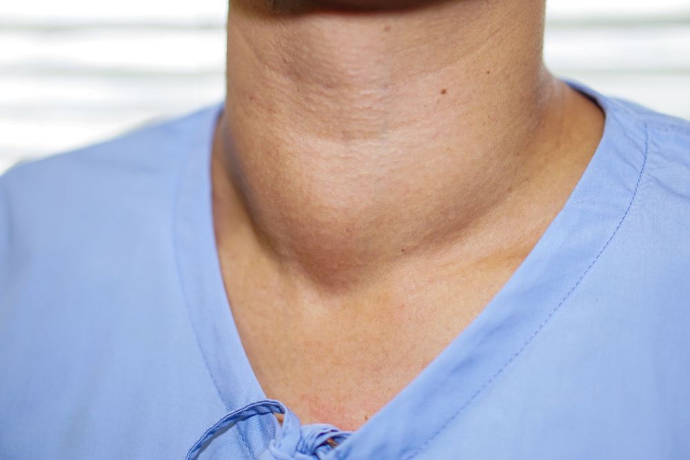 Photo of a person's neck