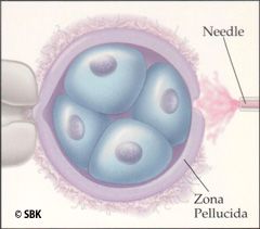 Assisted Hatching illustration