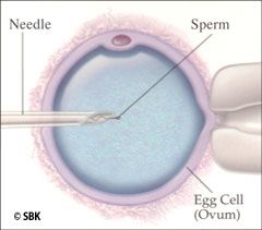 Illustrations of in vitro fertilization