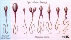 Semen Analysis chart